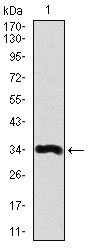 LPA / Lipoprotein a Antibody - Western blot using LPA monoclonal antibody against human LPA recombinant protein. (Expected MW is 34.1 kDa)
