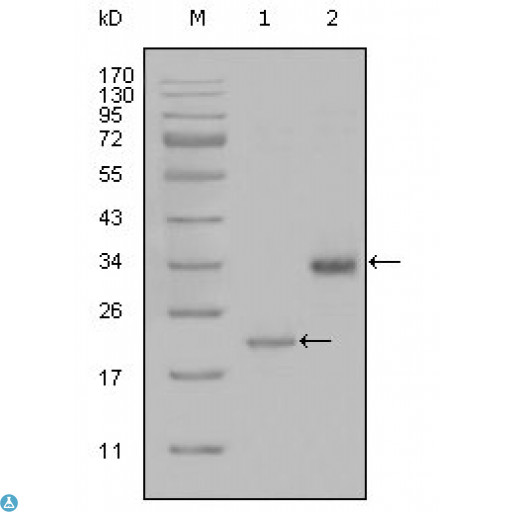 LPA / Lipoprotein a Antibody - Western Blot (WB) analysis using ApoA Monoclonal Antibody against truncated LPA-His recombinant protein (1) and truncated Trx-LPA(aa4330-4521) recombinant protein (2).