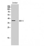 LPAR1 / LPA1 / EDG2 Antibody - Western blot of EDG-2 antibody