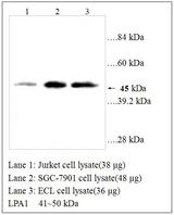 LPAR1 / LPA1 / EDG2 Antibody