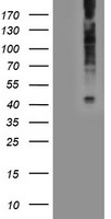 LPAR1 / LPA1 / EDG2 Antibody - HEK293T cells were transfected with the pCMV6-ENTRY control (Left lane) or pCMV6-ENTRY LPAR1 (Right lane) cDNA for 48 hrs and lysed. Equivalent amounts of cell lysates (5 ug per lane) were separated by SDS-PAGE and immunoblotted with anti-LPAR1.