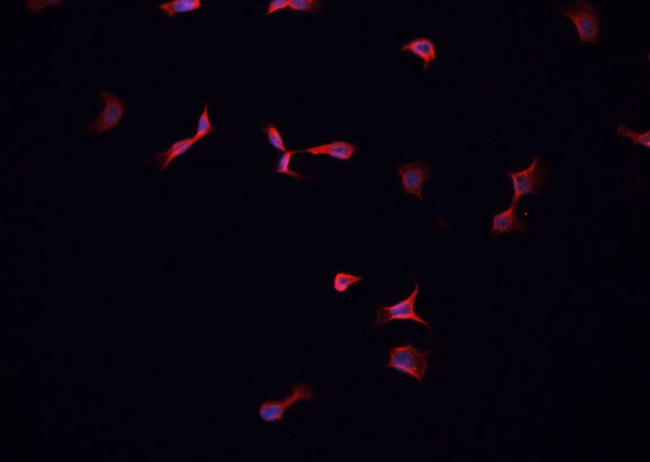 LPAR1 / LPA1 / EDG2 Antibody - Staining PC-3 cells by IF/ICC. The samples were fixed with PFA and permeabilized in 0.1% Triton X-100, then blocked in 10% serum for 45 min at 25°C. The primary antibody was diluted at 1:200 and incubated with the sample for 1 hour at 37°C. An Alexa Fluor 594 conjugated goat anti-rabbit IgG (H+L) antibody, diluted at 1/600, was used as secondary antibody.