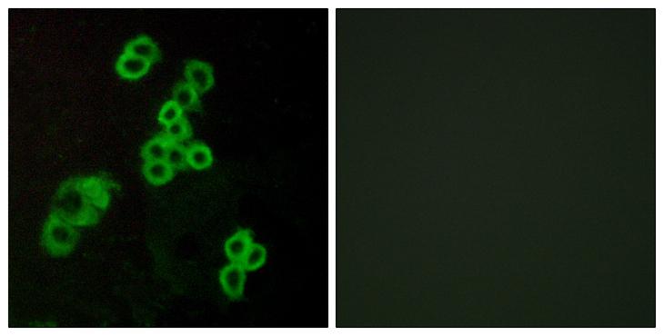 LPAR1 / LPA1 / EDG2 Antibody - Peptide - + Immunofluorescence analysis of MCF-7 cells, using EDG2 antibody.