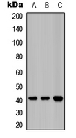 LPAR1 / LPA1 / EDG2 Antibody - Western blot analysis of EDG2 expression in HeLa (A); A549 (B); mouse heart (C) whole cell lysates.