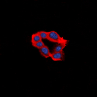 LPAR1 / LPA1 / EDG2 Antibody - Immunofluorescent analysis of EDG2 staining in HeLa cells. Formalin-fixed cells were permeabilized with 0.1% Triton X-100 in TBS for 5-10 minutes and blocked with 3% BSA-PBS for 30 minutes at room temperature. Cells were probed with the primary antibody in 3% BSA-PBS and incubated overnight at 4 deg C in a humidified chamber. Cells were washed with PBST and incubated with a DyLight 594-conjugated secondary antibody (red) in PBS at room temperature in the dark. DAPI was used to stain the cell nuclei (blue).