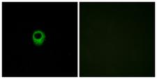 LPAR2 / EDG4 Antibody - Immunofluorescence analysis of MCF7 cells, using EDG4 Antibody. The picture on the right is blocked with the synthesized peptide.