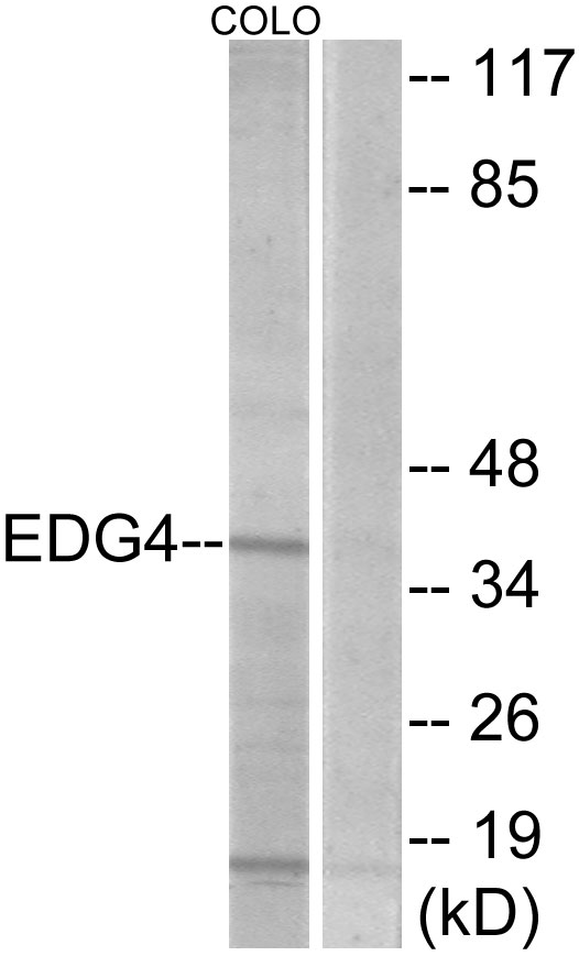 LPAR2 / EDG4 Antibody - Western blot analysis of lysates from COLO205 cells, using EDG4 Antibody. The lane on the right is blocked with the synthesized peptide.