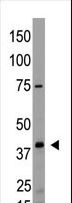 LPAR2 / EDG4 Antibody - The anti-EDG4 N-term Antibody is used in Western blot to detect EDG4 in HL60 lysate.