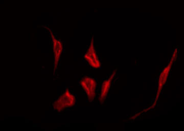 LPAR2 / EDG4 Antibody - Staining COLO205 cells by IF/ICC. The samples were fixed with PFA and permeabilized in 0.1% Triton X-100, then blocked in 10% serum for 45 min at 25°C. The primary antibody was diluted at 1:200 and incubated with the sample for 1 hour at 37°C. An Alexa Fluor 594 conjugated goat anti-rabbit IgG (H+L) Ab, diluted at 1/600, was used as the secondary antibody.