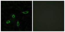 LPAR2 / EDG4 Antibody - Peptide - + Immunofluorescence analysis of LOVO cells, using EDG4 antibody.