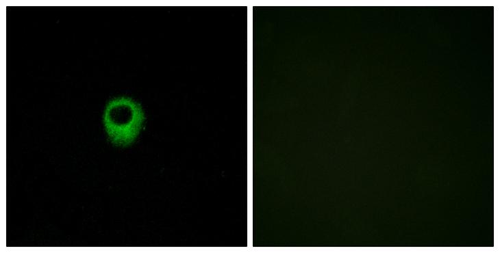 LPAR2 / EDG4 Antibody - Peptide - + Immunofluorescence analysis of MCF-7 cells, using EDG4 antibody.