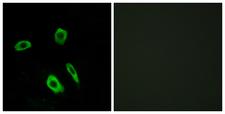 LPAR3 / LPA3 / EDG7 Antibody - Immunofluorescence analysis of LOVO cells, using EDG7 Antibody. The picture on the right is blocked with the synthesized peptide.