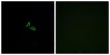 LPAR3 / LPA3 / EDG7 Antibody - Immunofluorescence analysis of A549 cells, using EDG7 Antibody. The picture on the right is blocked with the synthesized peptide.