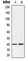 LPAR3 / LPA3 / EDG7 Antibody - Western blot analysis of EDG7 expression in HepG2 (A); NT2D1 (B) whole cell lysates.