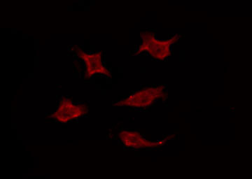 LPAR3 / LPA3 / EDG7 Antibody - Staining HeLa cells by IF/ICC. The samples were fixed with PFA and permeabilized in 0.1% Triton X-100, then blocked in 10% serum for 45 min at 25°C. The primary antibody was diluted at 1:200 and incubated with the sample for 1 hour at 37°C. An Alexa Fluor 594 conjugated goat anti-rabbit IgG (H+L) Ab, diluted at 1/600, was used as the secondary antibody.
