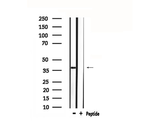 LPAR3 / LPA3 / EDG7 Antibody - Western blot analysis of extracts of rat spleen using EDG7 antibody.