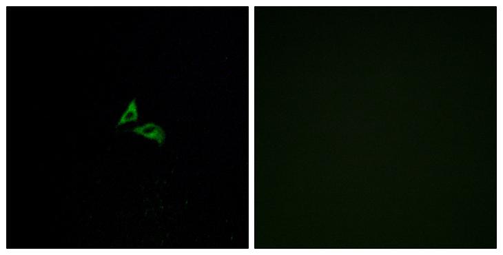 LPAR3 / LPA3 / EDG7 Antibody - Peptide - + Immunofluorescence analysis of A549 cells, using EDG7 antibody.