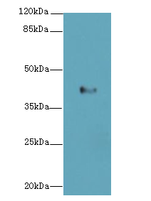 LPAR4 / GPR23 Antibody - Western blot. All lanes: LPAR4 antibody at 4 ug/ml+Mos- kidney tissue Goat polyclonal to rabbit at 1:10000 dilution. Predicted band size: 42 kDa. Observed band size: 42 kDa.
