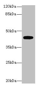 LPAR4 / GPR23 Antibody - Western blot All lanes: LPAR4 antibody at 4µg/ml + Mouse kidney tissue Secondary Goat polyclonal to rabbit IgG at 1/10000 dilution Predicted band size: 42 kDa Observed band size: 42 kDa