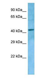 LPAR5 / GPR92 Antibody - LPAR5 / GPR92 antibody Western Blot of HeLa cell lysate.  This image was taken for the unconjugated form of this product. Other forms have not been tested.