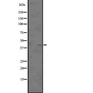 LPAR5 / GPR92 Antibody - Western blot analysis of GPR92/GPR93 expression in A431 whole cells lysate. The lane on the left is treated with the antigen-specific peptide.