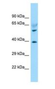 LPAR6 / P2RY5 / P2Y5 Antibody - LPAR6 / P2RY5 / P2Y5 antibody Western Blot of Fetal Heart.  This image was taken for the unconjugated form of this product. Other forms have not been tested.