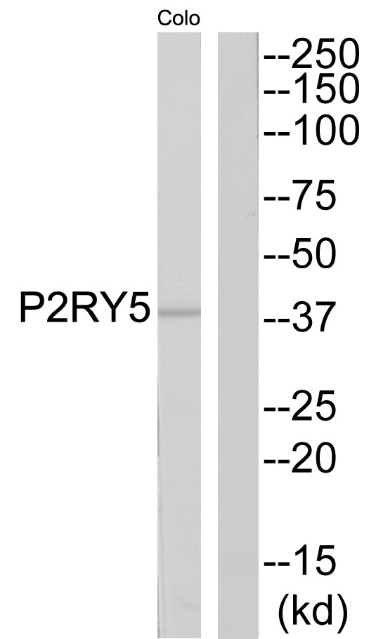 LPAR6 / P2RY5 / P2Y5 Antibody - Western blot of extracts from COLO cells, using P2RY5 antibody.