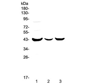 LPAR6 / P2RY5 / P2Y5 Antibody - Western blot testing of human 1) MCF7, 2) HepG2 and 3) SK-OV-3 cell lysate with P2RY5 antibody at 0.5ug/ml. Predicted molecular weight ~39 kDa.