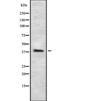 LPAR6 / P2RY5 / P2Y5 Antibody - Western blot analysis of P2RY5 using HeLa whole cells lysates
