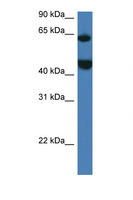 LPCAT2 Antibody - LPCAT2 antibody Western blot of Mouse Thymus lysate. Antibody concentration 1 ug/ml.  This image was taken for the unconjugated form of this product. Other forms have not been tested.
