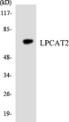 LPCAT2 Antibody - Western blot analysis of the lysates from HT-29 cells using LPCAT2 antibody.