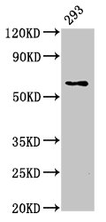 LPCAT2 Antibody - Positive Western Blot detected in 293 whole cell lysate. All lanes: LPCAT2 antibody at 5 µg/ml Secondary Goat polyclonal to rabbit IgG at 1/50000 dilution. Predicted band size: 61, 31 KDa. Observed band size: 61 KDa