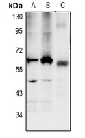 LPCAT2 Antibody - Western blot analysis of LPCAT2 expression in HCT116 (A), DLD (B), mouse colon (C) whole cell lysates.