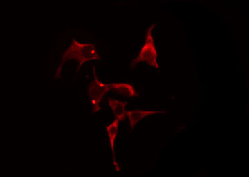 LPCAT2 Antibody - Staining HeLa cells by IF/ICC. The samples were fixed with PFA and permeabilized in 0.1% Triton X-100, then blocked in 10% serum for 45 min at 25°C. The primary antibody was diluted at 1:200 and incubated with the sample for 1 hour at 37°C. An Alexa Fluor 594 conjugated goat anti-rabbit IgG (H+L) antibody, diluted at 1/600, was used as secondary antibody.