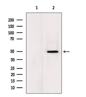 LPCAT2 Antibody - Western blot analysis of extracts of rat heart tissue using LPCAT2 antibody. Lane 1 was treated with the blocking peptide.