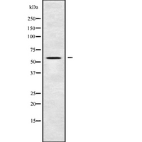 LPCAT4 Antibody - Western blot analysis of AGPAT7 using HT29 whole cells lysates