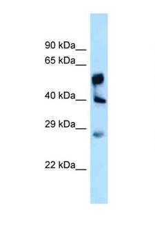 LPGAT1 Antibody - LPGAT1 antibody Western blot of Fetal Liver lysate. Antibody concentration 1 ug/ml.  This image was taken for the unconjugated form of this product. Other forms have not been tested.