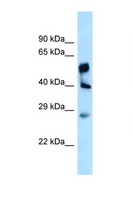 LPGAT1 Antibody - LPGAT1 antibody Western blot of Fetal Liver lysate. Antibody concentration 1 ug/ml.  This image was taken for the unconjugated form of this product. Other forms have not been tested.