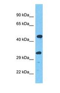 LPGAT1 Antibody - Western blot of LPGAT1 Antibody with human A549 Whole Cell lysate.  This image was taken for the unconjugated form of this product. Other forms have not been tested.