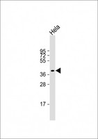 LPGAT1 Antibody - Anti-LPGAT1 Antibody (Center) at 1:2000 dilution + Hela whole cell lysate Lysates/proteins at 20 µg per lane. Secondary Goat Anti-Rabbit IgG, (H+L), Peroxidase conjugated at 1/10000 dilution. Predicted band size: 43 kDa Blocking/Dilution buffer: 5% NFDM/TBST.