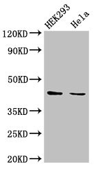 LPGAT1 Antibody - Western Blot Positive WB detected in: HEK293 whole cell lysate, Hela whole cell lysate All lanes: LPGAT1 antibody at 3µg/ml Secondary Goat polyclonal to rabbit IgG at 1/50000 dilution Predicted band size: 44 kDa Observed band size: 44 kDa