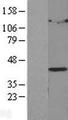 LPGAT1 Protein - Western validation with an anti-DDK antibody * L: Control HEK293 lysate R: Over-expression lysate