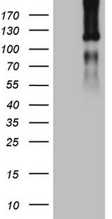 LPIN1 / Lipin 1 Antibody - HEK293T cells were transfected with the pCMV6-ENTRY control. (Left lane) or pCMV6-ENTRY LPIN1. (Right lane) cDNA for 48 hrs and lysed. Equivalent amounts of cell lysates. (5 ug per lane) were separated by SDS-PAGE and immunoblotted with anti-LPIN1. (1:2000)