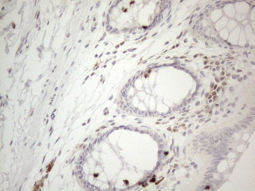 LPIN1 / Lipin 1 Antibody - Immunohistochemical staining of paraffin-embedded Human colon tissue within the normal limits using anti-LPIN1 mouse monoclonal antibody. (Heat-induced epitope retrieval by 1mM EDTA in 10mM Tris buffer. (pH8.5) at 120°C for 3 min. (1:150)