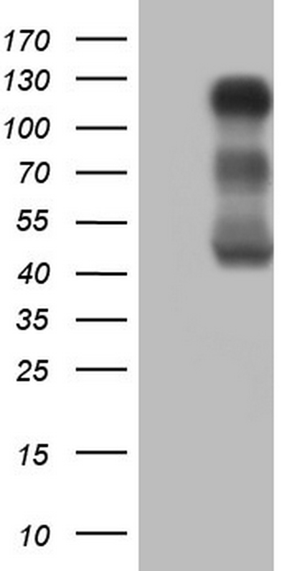 LPIN1 / Lipin 1 Antibody - HEK293T cells were transfected with the pCMV6-ENTRY control. (Left lane) or pCMV6-ENTRY LPIN1. (Right lane) cDNA for 48 hrs and lysed. Equivalent amounts of cell lysates. (5 ug per lane) were separated by SDS-PAGE and immunoblotted with anti-LPIN1.