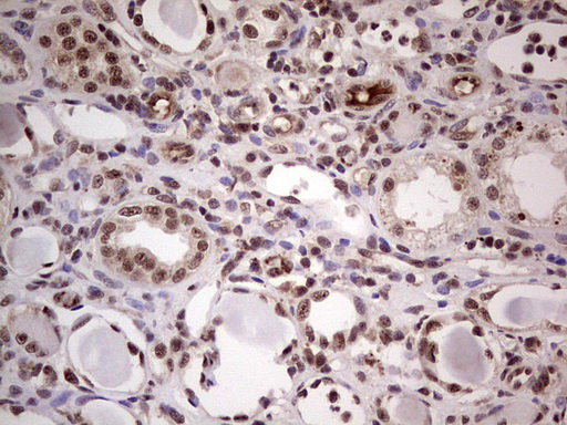 LPIN1 / Lipin 1 Antibody - Immunohistochemical staining of paraffin-embedded Human Kidney tissue within the normal limits using anti-LPIN1 mouse monoclonal antibody. (Heat-induced epitope retrieval by 1 mM EDTA in 10mM Tris, pH8.5, 120C for 3min,