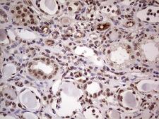 LPIN1 / Lipin 1 Antibody - IHC of paraffin-embedded Human Kidney tissue using anti-LPIN1 mouse monoclonal antibody. (Heat-induced epitope retrieval by 1 mM EDTA in 10mM Tris, pH8.5, 120°C for 3min).
