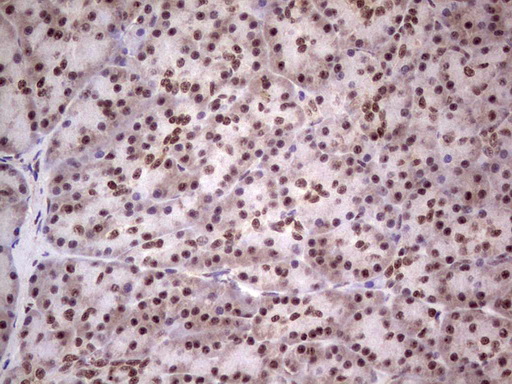 LPIN1 / Lipin 1 Antibody - IHC of paraffin-embedded Human pancreas tissue using anti-LPIN1 mouse monoclonal antibody. (Heat-induced epitope retrieval by 1 mM EDTA in 10mM Tris, pH8.5, 120°C for 3min).