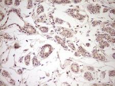 LPIN1 / Lipin 1 Antibody - Immunohistochemical staining of paraffin-embedded Human breast tissue within the normal limits using anti-LPIN1 mouse monoclonal antibody. (Heat-induced epitope retrieval by 1 mM EDTA in 10mM Tris, pH8.5, 120C for 3min,