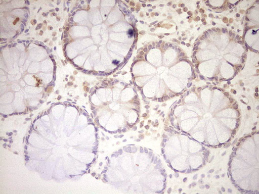 LPIN1 / Lipin 1 Antibody - Immunohistochemical staining of paraffin-embedded Human colon tissue within the normal limits using anti-LPIN1 mouse monoclonal antibody. (Heat-induced epitope retrieval by 1 mM EDTA in 10mM Tris, pH8.5, 120C for 3min,